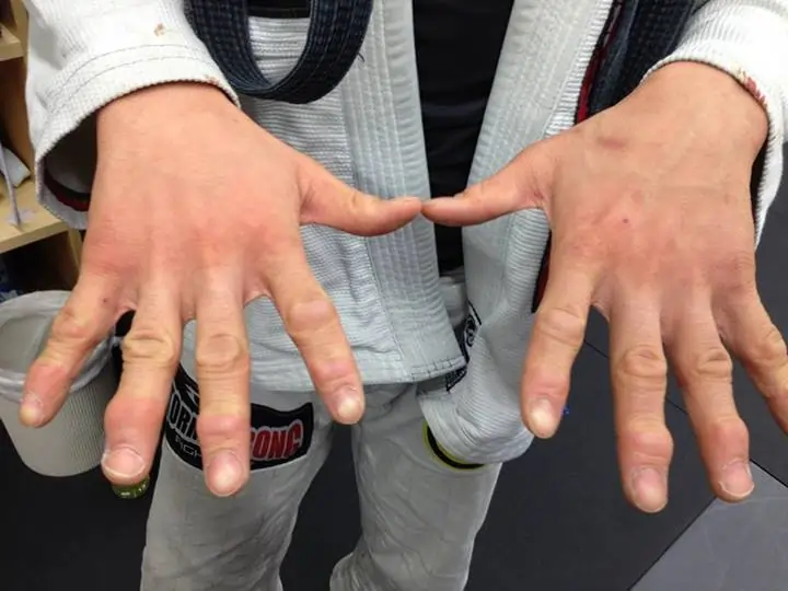 Jiu Jitsu Fingers of João Miyao