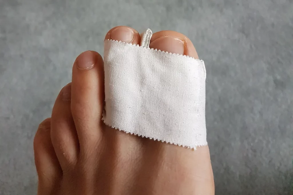 Fixated big toe with spacer