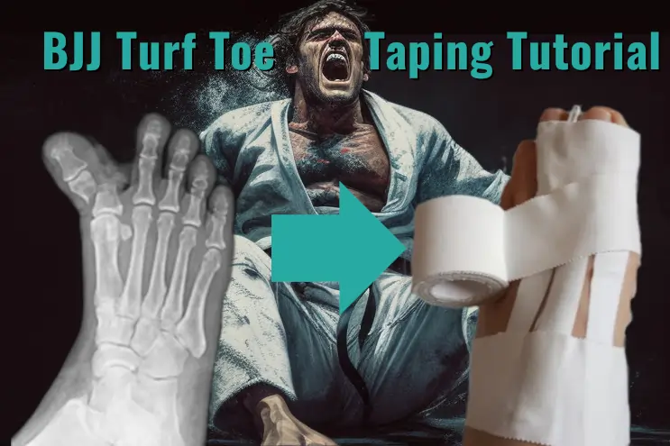 BJJ Turf Toe: How to Tape, Treat and Prevent BJJ Toe Injuries