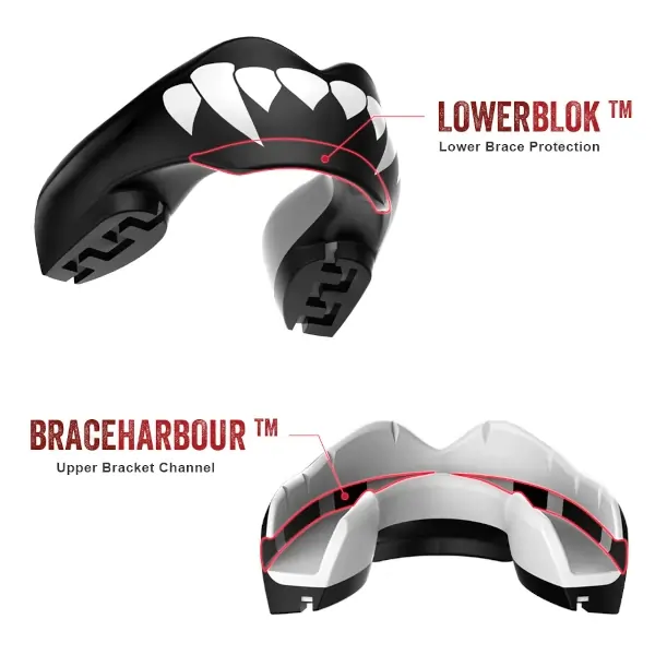 Safejawz Extro Mouthguard before and after fitting